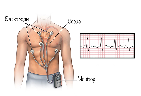 holter